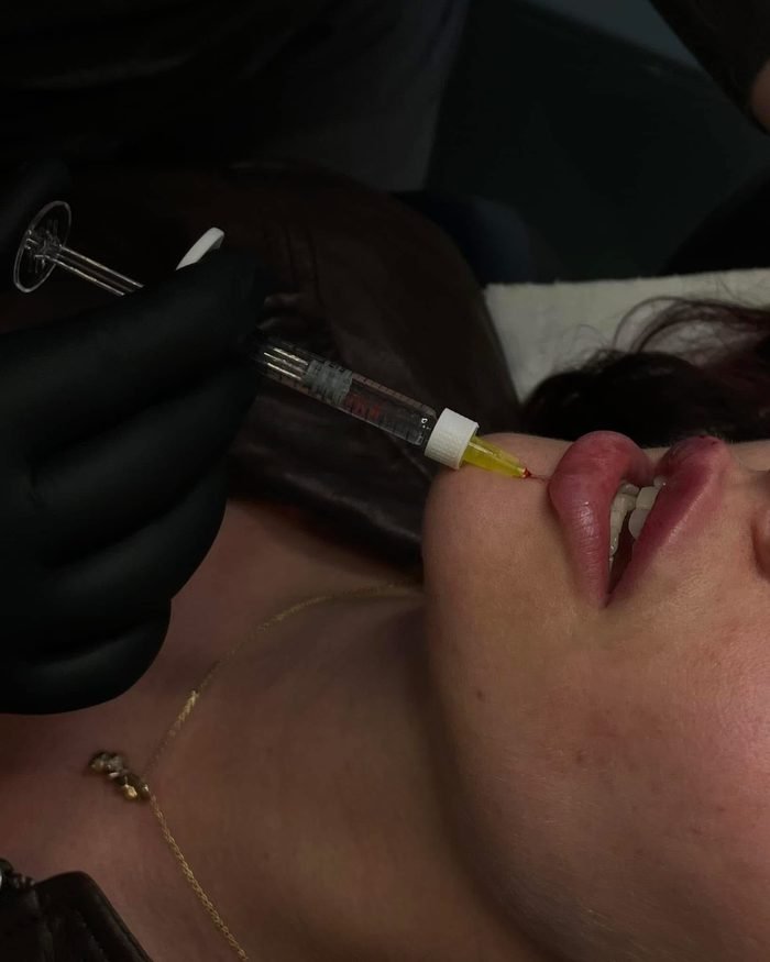 Hands-on aesthetic training