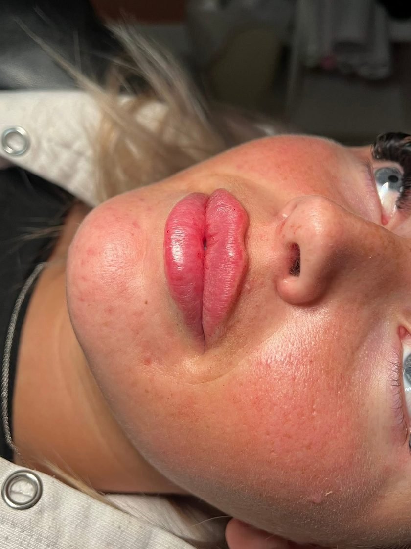 A Russian lip masterclass in progress